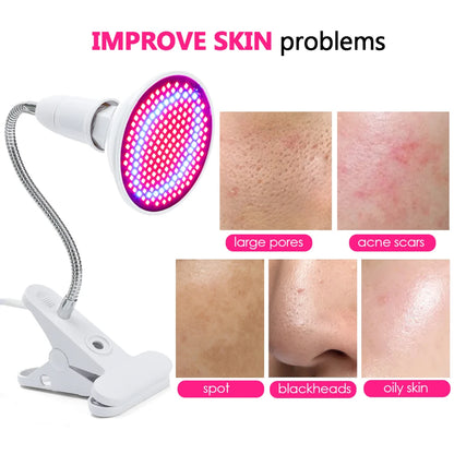 LED Gezichtsmasker – Lichttherapie